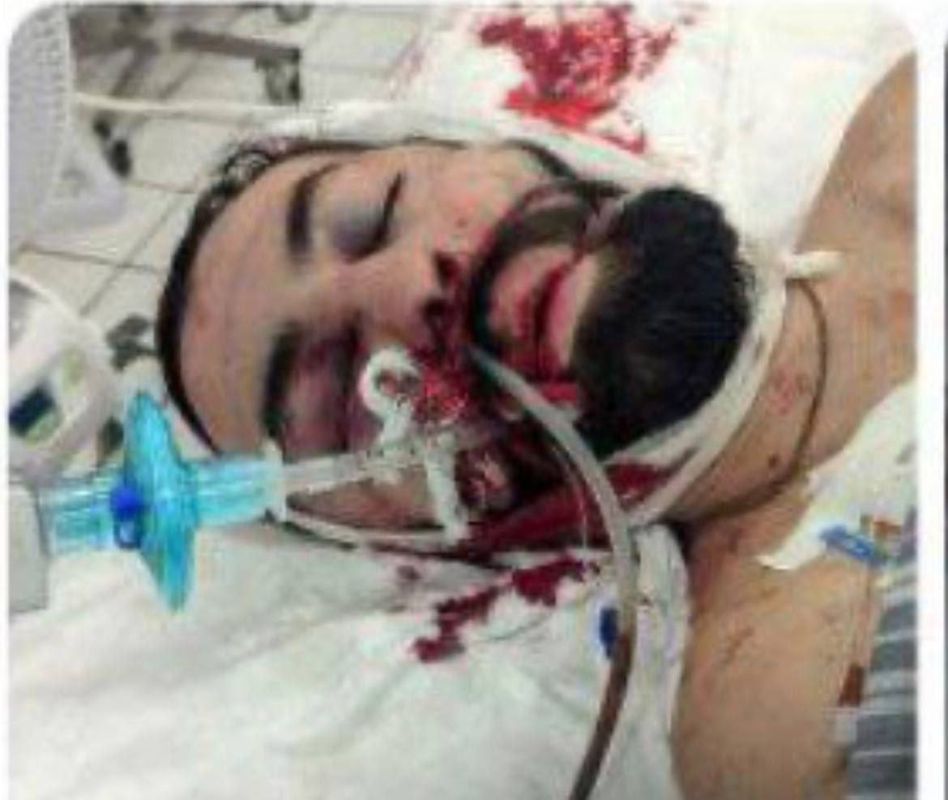 ���� �������: � ���� ��� ������ ����� �������� ��������-������ �������� �����������, ������� 4 ������� 2 ���������� ������� 8 ����� �� �� ����� ��������