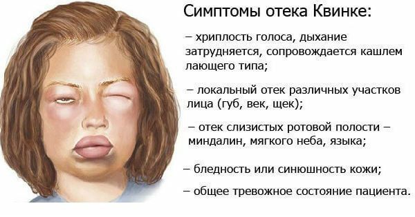 ���� ������ - ������ ������