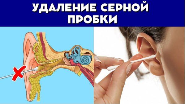 ����� ������: ����� ���������� ������� ������