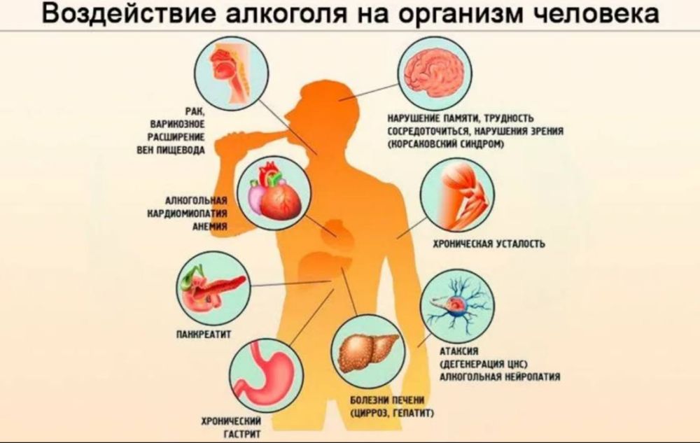 ��������: ������� ������� ������������