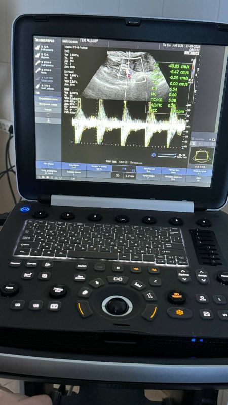 ������� �����: ��������������� �� ����� - ��� � ������