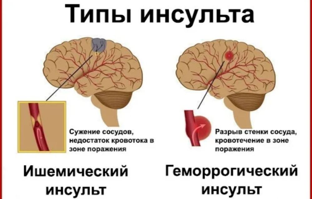 ������� � ��������: ��� �������� ���������