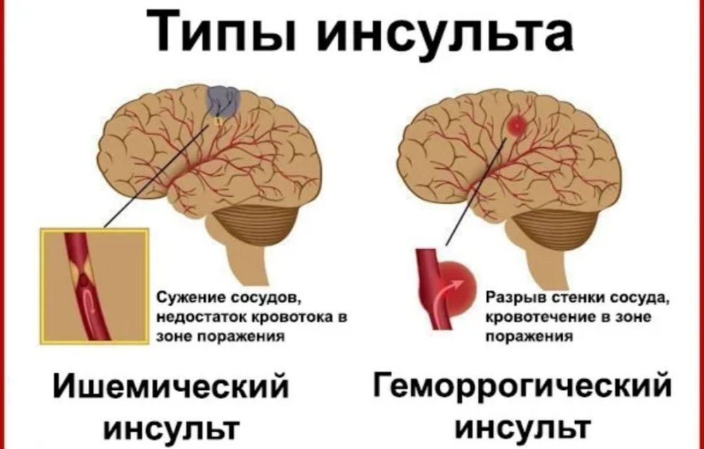 ������� � ��������: ��� �������� ���������