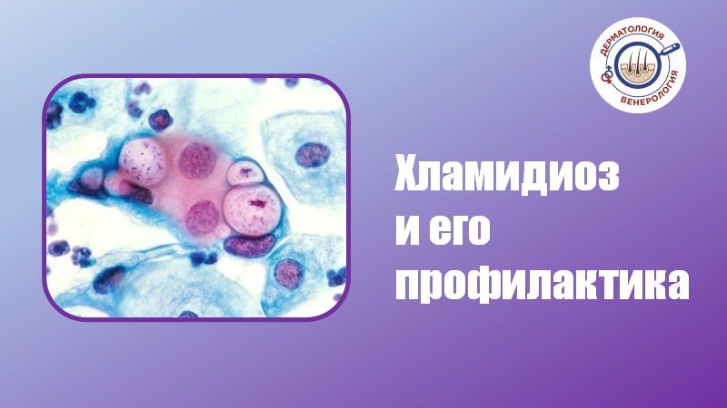 ��������� � ��� ������������ �����������, ���������� ��������� Chlamydia trachomatis