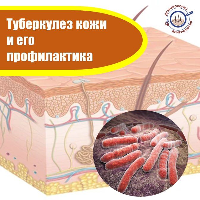 ���������� ���� � ��� ������������ �����������, ���������� ��������� Mycobacterium tuberculosis
