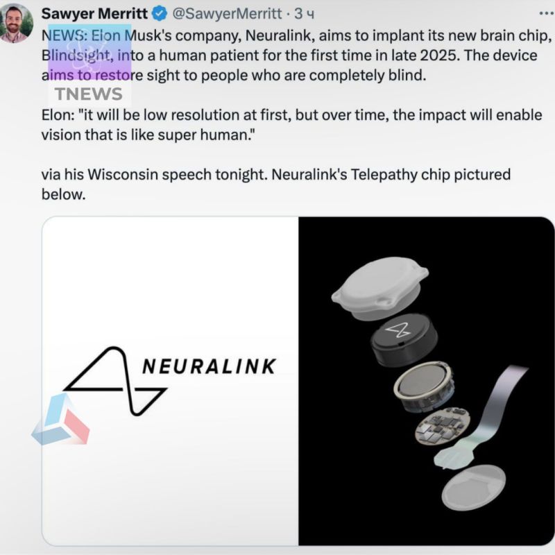 �����News: Neuralink ��������� ���������� Blindsight, ������� ���������� ������