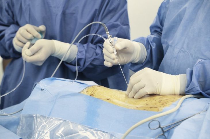 В Крыму прошла серия уникальных операций на сонной артерии