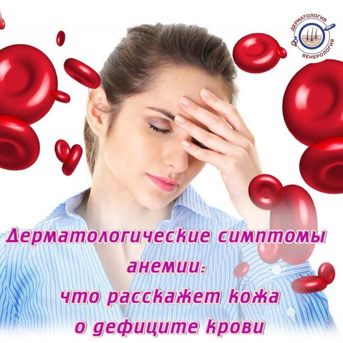 � ��� �� ������ �����������, � ���������, ����� ��������� ��������������� �� ������� ���������