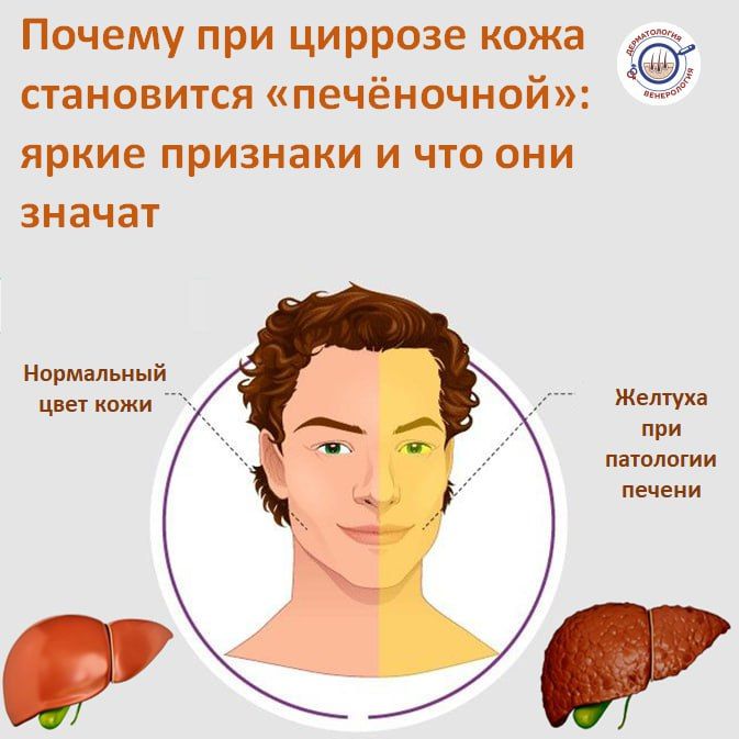 ����� ������ ������ �������������, ���� ���������� ��������� "�������� ���������" ������� � ���������� ����������� ����������� ��������, ������� ������ �� ��������