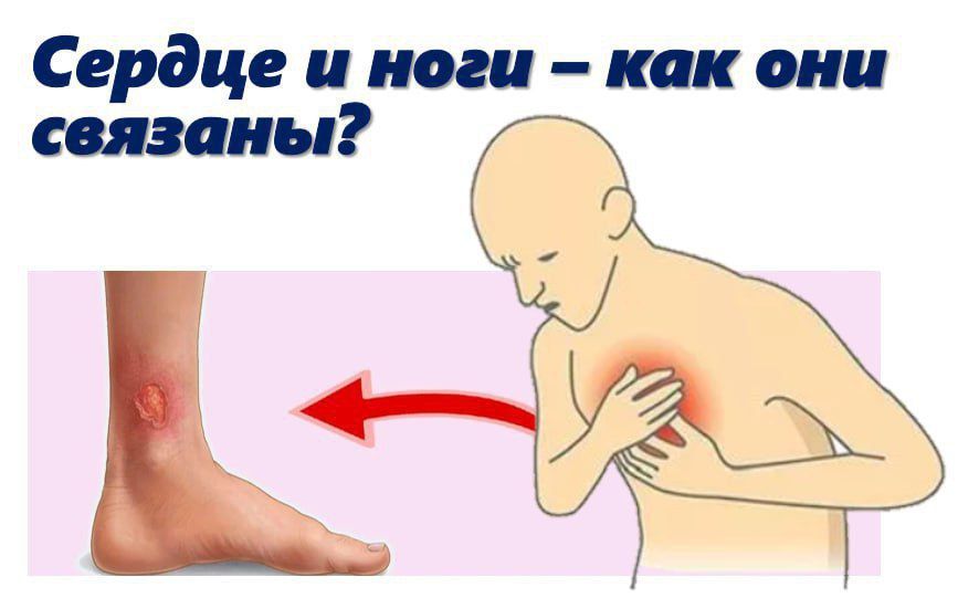 ������ � ����: ��� ��� �������?