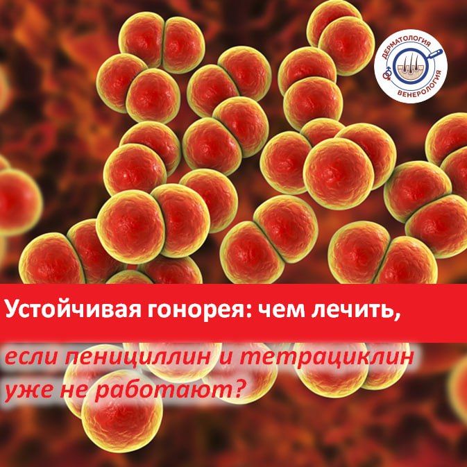 ������� � ���� �� ����� ������� ��������, �� ������� ��� ������������ � ��������� ������ ��-�� ����� �����������������