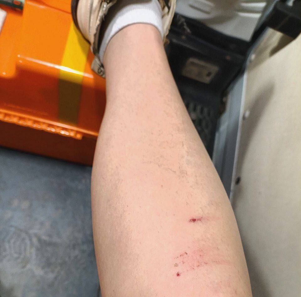 Тревожные новости приходят из Луганска: уличные собаки вновь напали на человека — соцсети