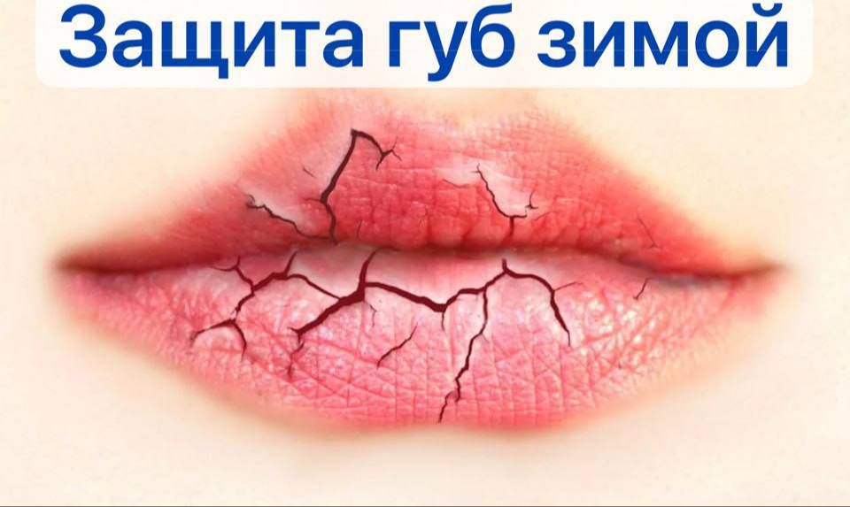 Защита губ зимой: как спасти их от мороза и ветра