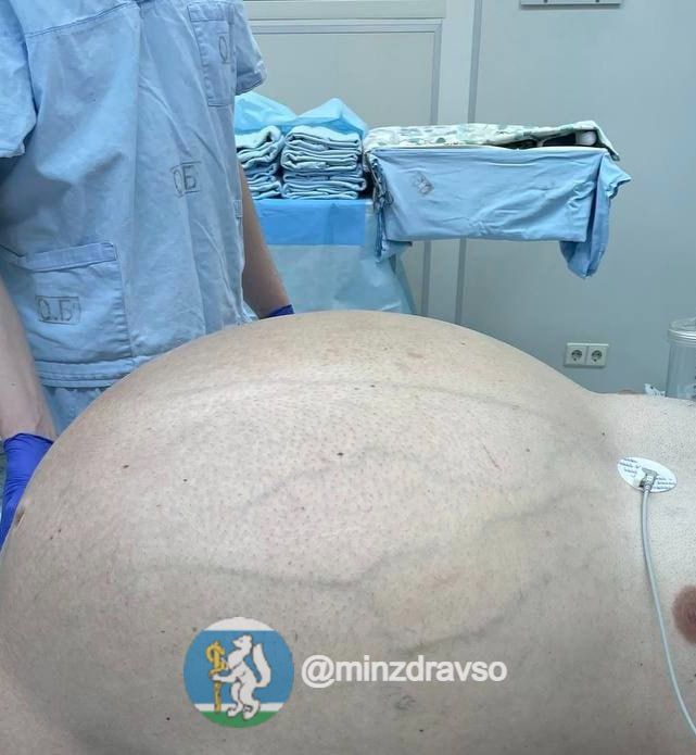 ������� ����� ����� 60 �� ������� � ������� ������������ ����� - �� ����� � ��� ����� 20 ���