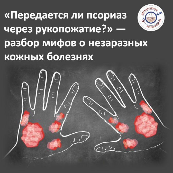 �������� �����: ���, ������� ����� ����������� �� ����������