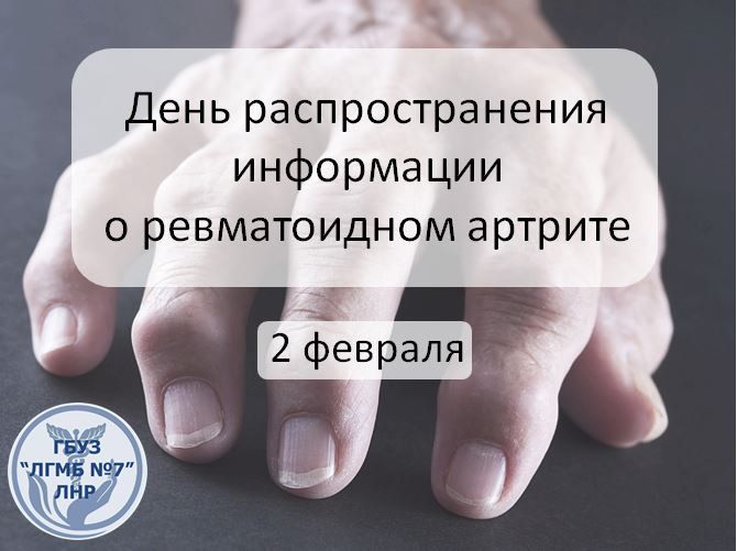 2 ������� ���������� ���� ��������������� ���������� � ������������ ������� (��)
