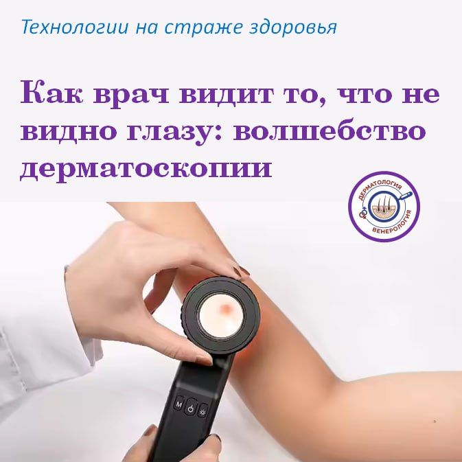 Знакомьтесь: дерматоскоп. Это не просто «увеличительное стекло» для кожи