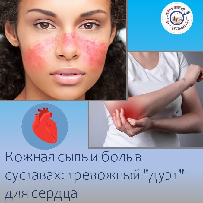 Иногда дерматолог может быть первым врачом, кто заподозрит серьезную проблему, затрагивающую не только кожу, но и внутренние органы, в том числе — сердце