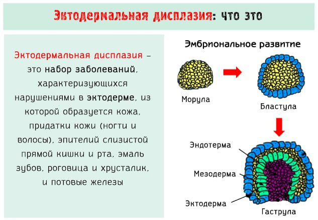 20 февраля - Международный день осведомленности об эктодермальных дисплазиях