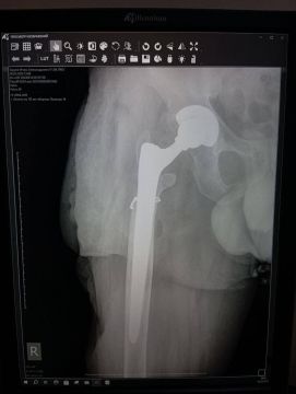 ���������� ��������: ����� �������� ������� �������� ��� ����������� ������ ��� �������