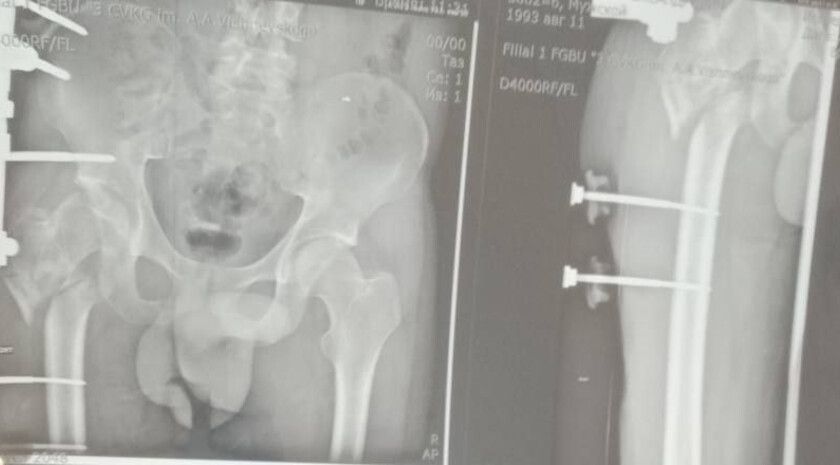 ���������� �������� � ���� ������� �������� ��� ����������� ������ ��� �������