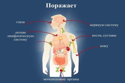 ���������� �������� �� ������ ������