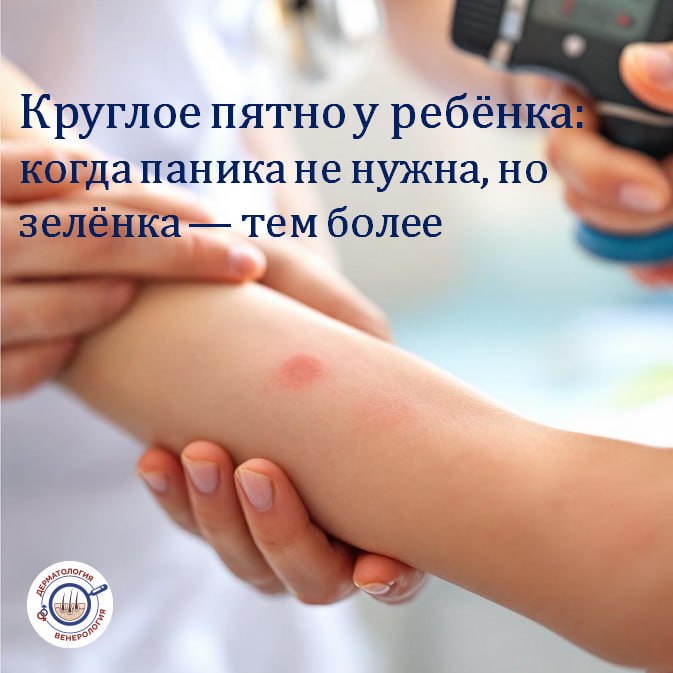 Если вы когда-нибудь гуглили «пятно у ребёнка шелушится» — вы не одиноки