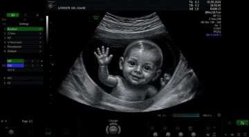 ������ �������� ������������ ����� �������� ������������ � �������� ���
