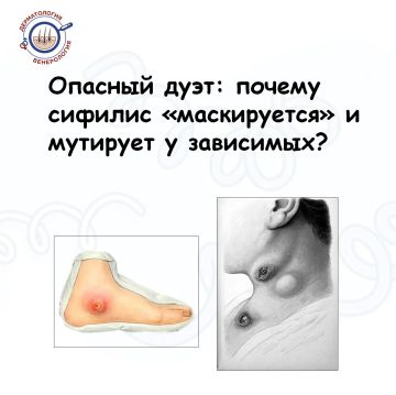 Когда мы говорим о профилактике наркомании, мы часто вспоминаем о печени, сердце или психике