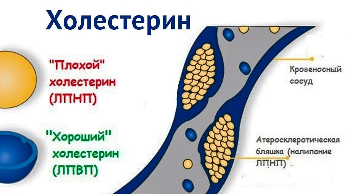«Тихий убийца»: что нужно знать о холестерине каждому?