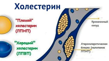 «Тихий убийца»: что нужно знать о холестерине каждому?