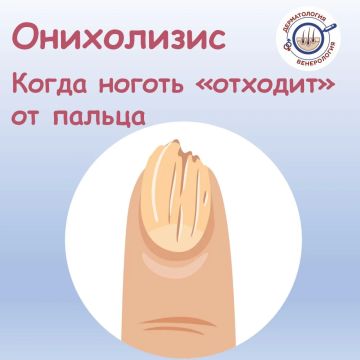 �� �������� �� ���� ����� � ���������, ��� � ������ �� ��� ��������� ���� � �� ���� ���������� ��� ���������, � ��� ��� ����� ������������ �������? ��� ���� ��� ������ �� ����� � �� ���������? ����������� - ����������