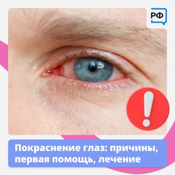Красные глаза — это красный флаг! Они прямо сигнализируют: пора обратить на них внимание