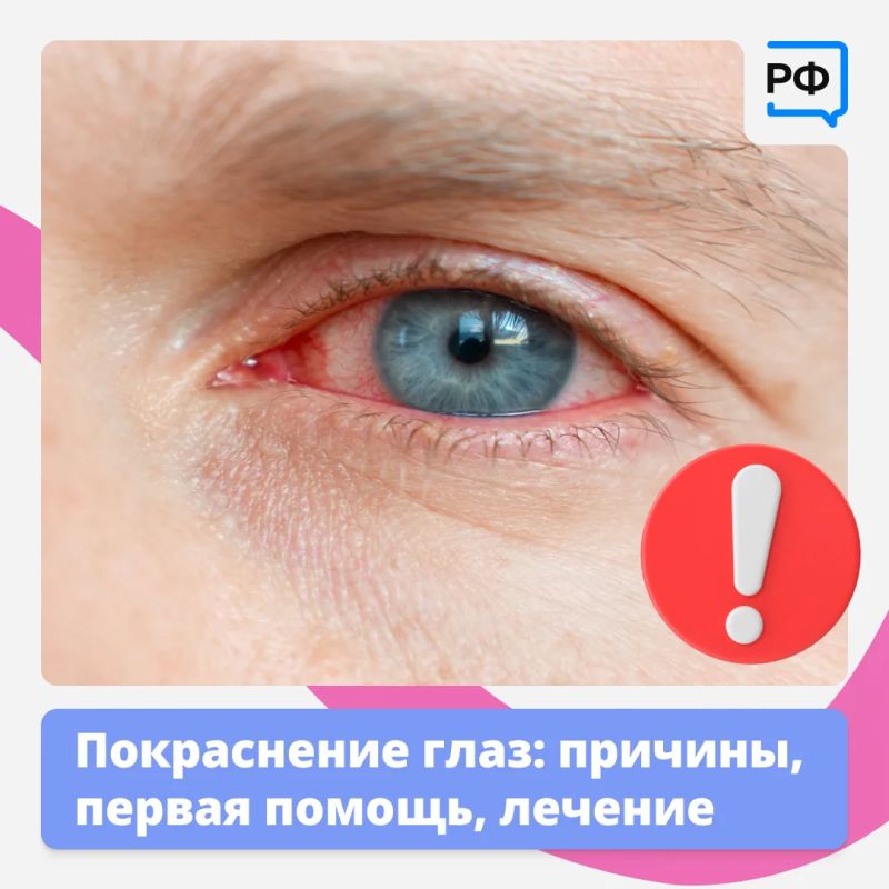 Красные глаза — это красный флаг! Они прямо сигнализируют: пора обратить на них внимание