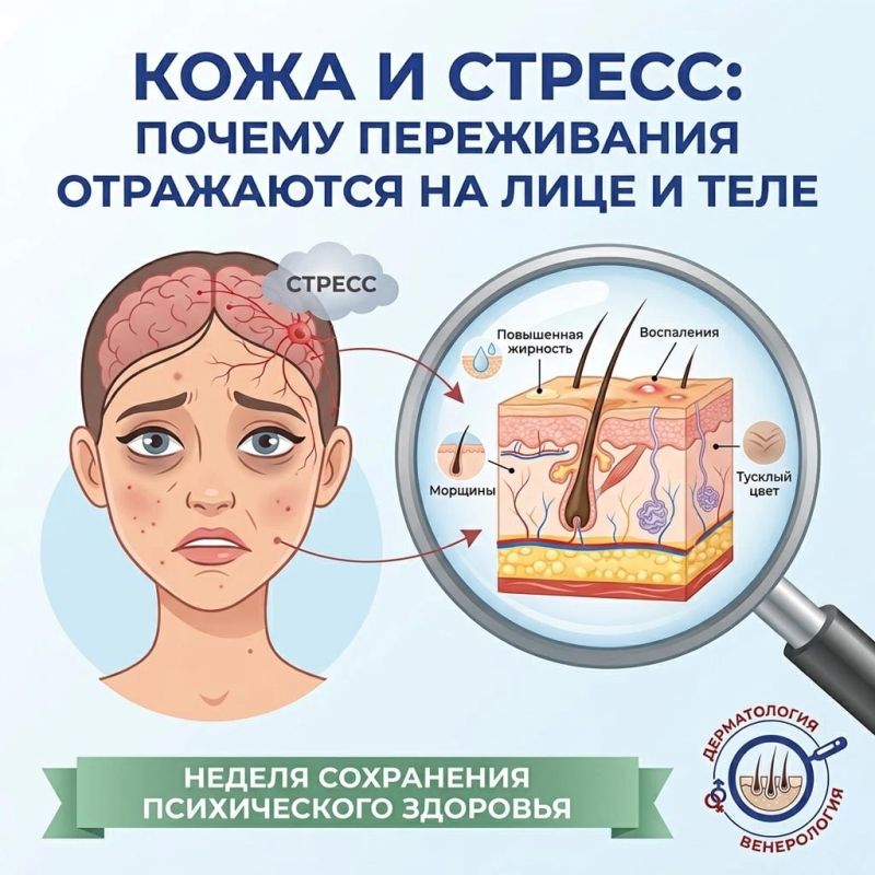 Кожа и стресс: почему переживания отражаются на лице и теле?