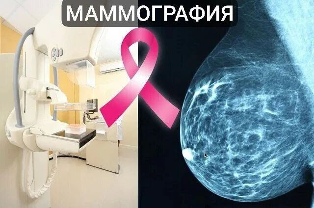 Маммография — это диагностический метод, предназначенный для раннего выявления заболеваний молочной железы, в первую очередь рака