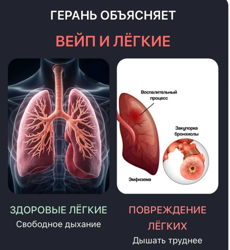 ГЕРАНЬ ОБЪЯСНЯЕТ| Вейпы и ХОБЛ: почему однажды может стать трудно дышать?